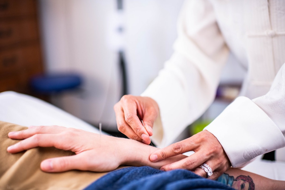 Alternative Healing with Acupuncture